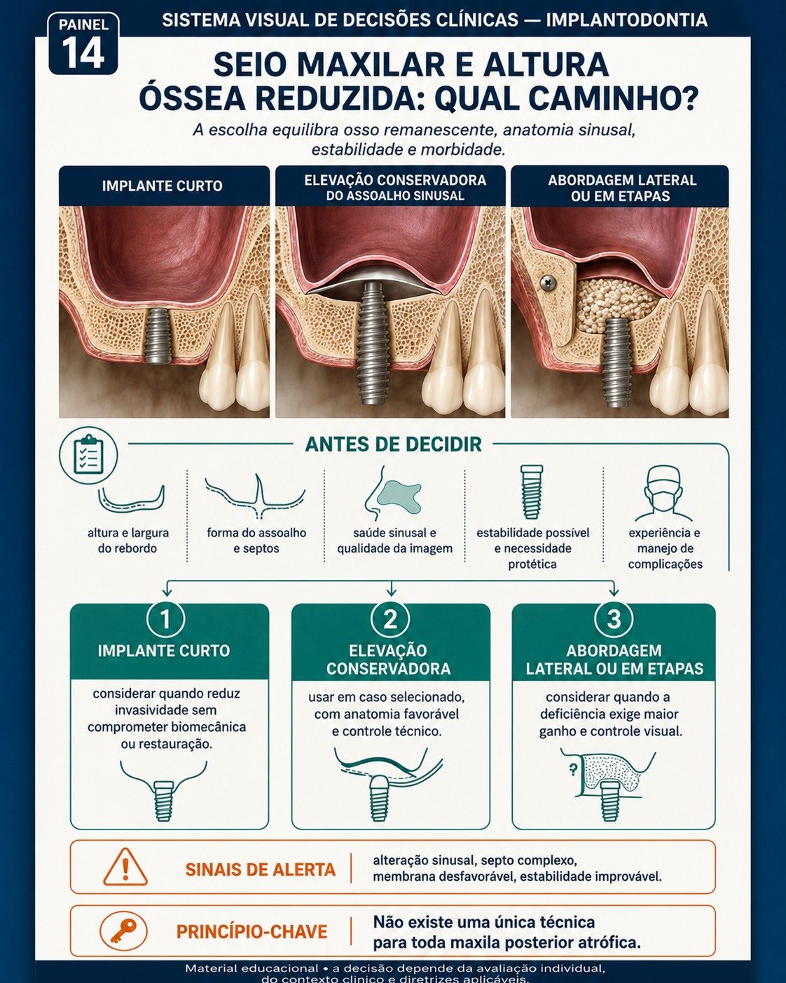 Painel visual de decisão clínica em Implantodontia